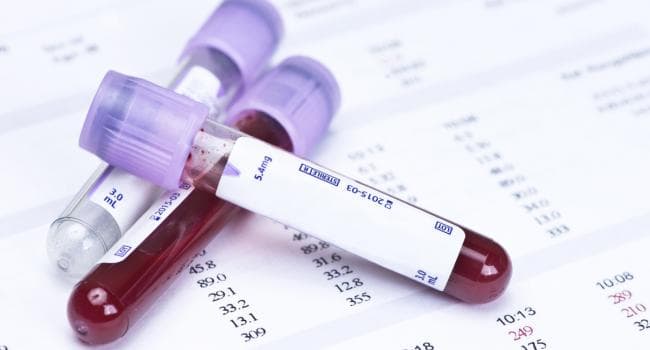 Medenine elderly man's AIDS-related death