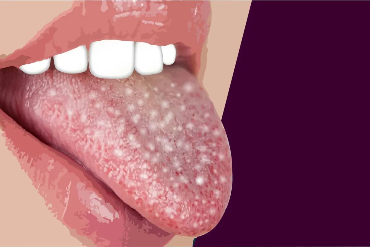 Tongue color and health signs