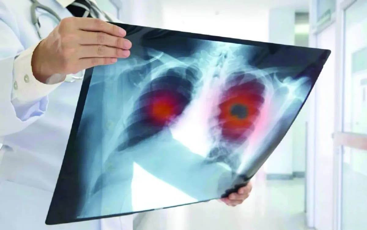 Study on Safe Conceiving Post-Genetic T Cell Therapy