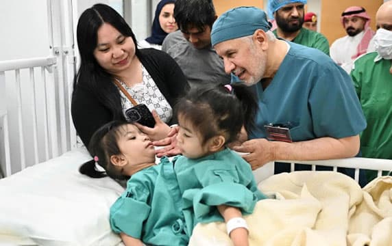 الأمم المتحدة: دعم السعودية للتوائم نموذج دولي