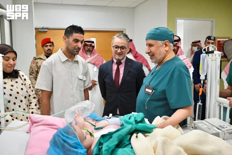فصل التوأم المغربي سجى ووضحى في الرياض