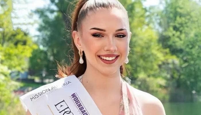 Austrian Miss Queen dies at 22 after multiple surgeries