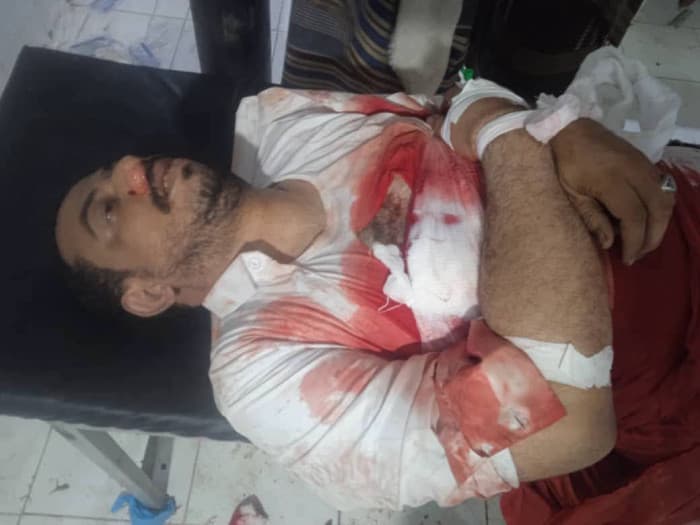 مقتل التاجر أحمد الكثيري في كمين بأبين