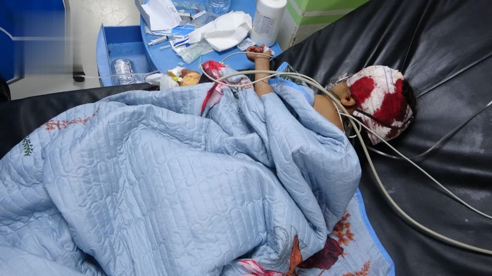 Girl injured by mercenary sniper in Al-Dhalea