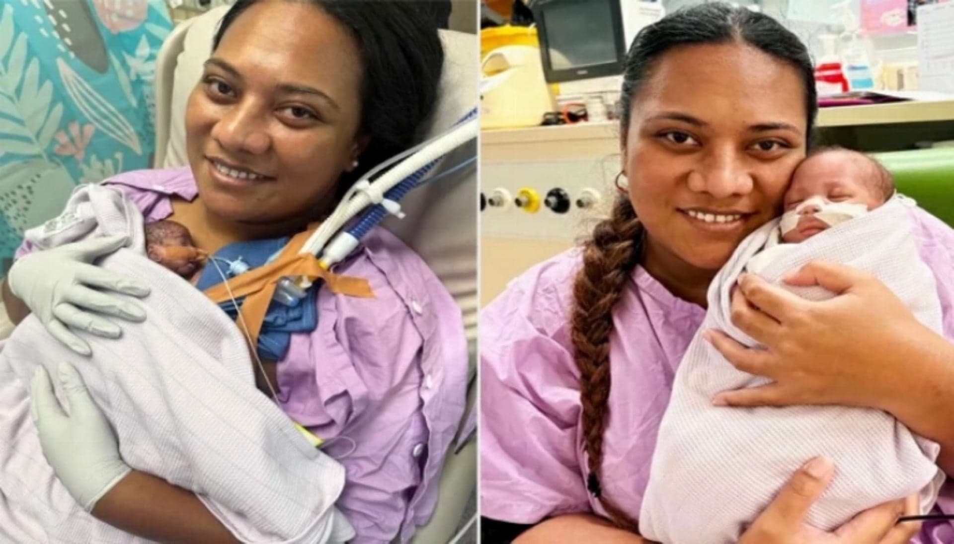 Australasian record for baby born at 21 weeks