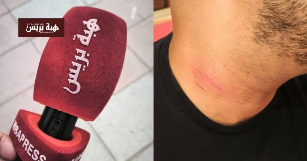 الاتحاد العربي يعبر عن استيائه من اعتداء سبتة