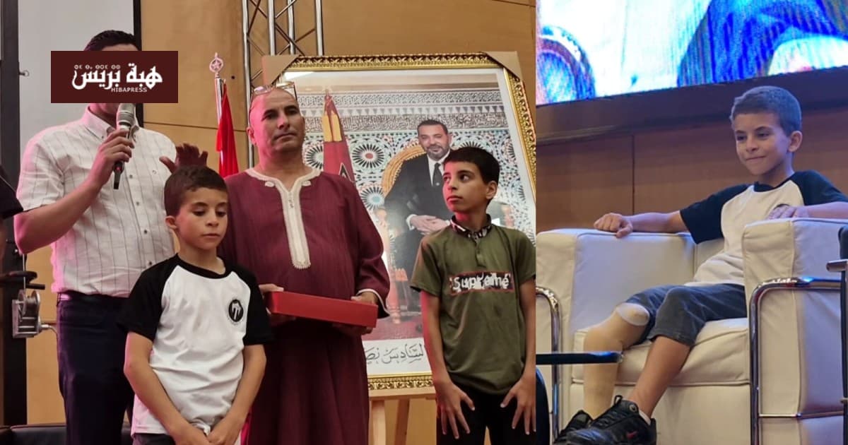 Oujda Islamic Union Honors Younes with Artificial Leg