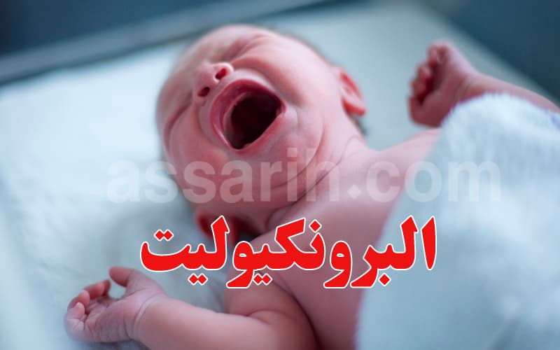 Winter infant bronchitis prevention tips