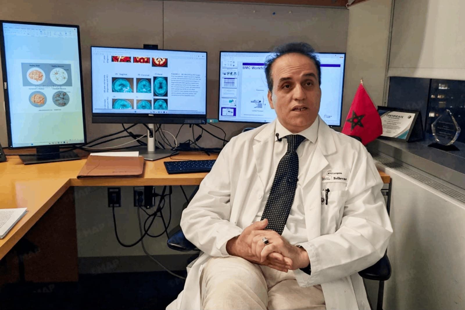 US study offers early Alzheimer's detection
