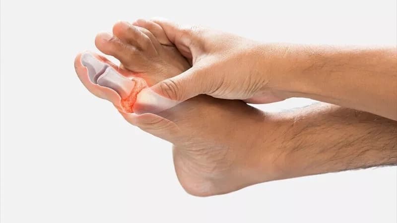 Impact of daily drinks on gout risk