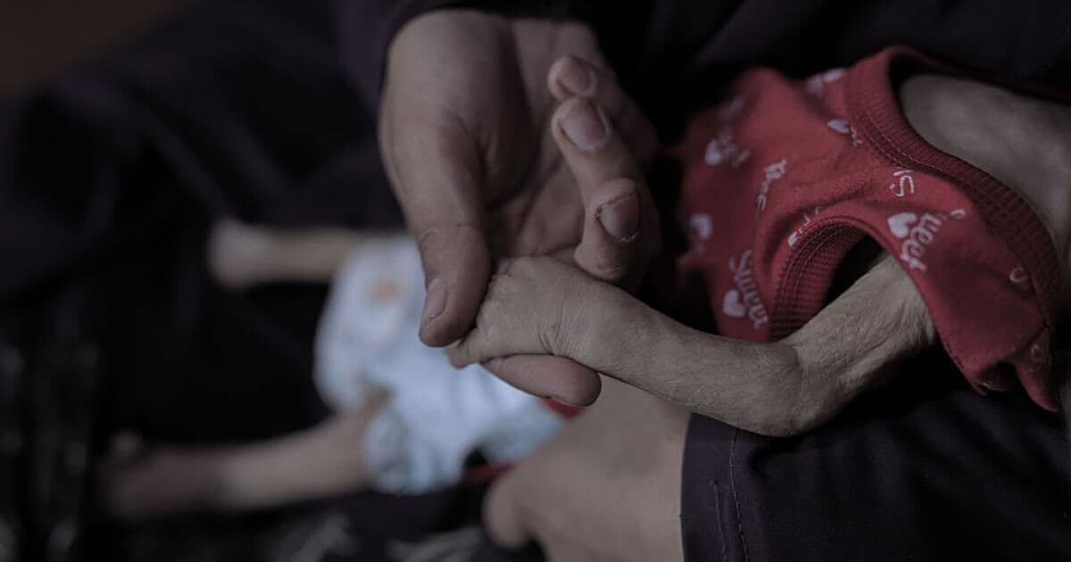 Malnutrition Kills Many in Gaza