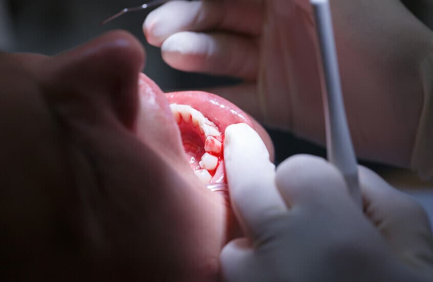 Gum issues may signal serious health problems