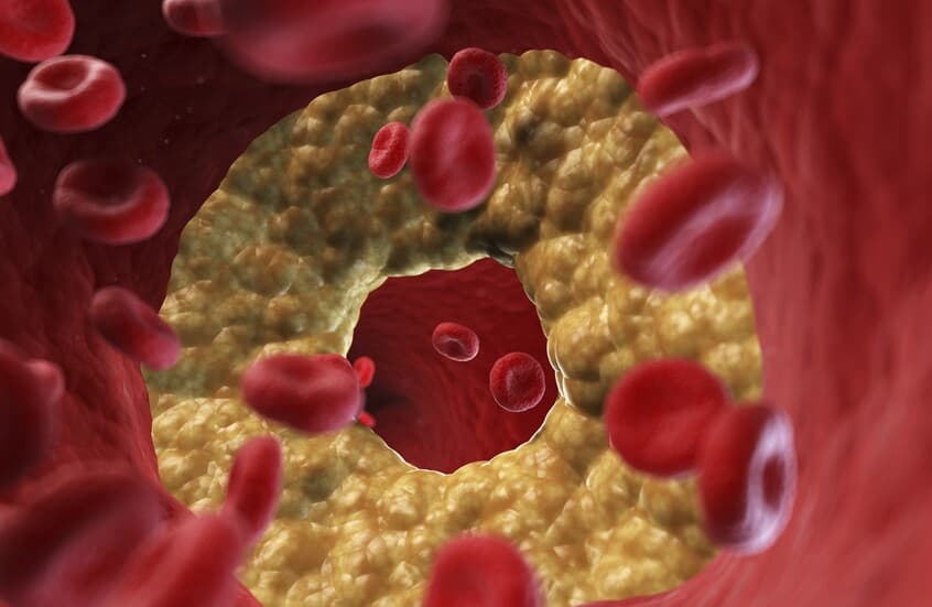 Popular diets may raise cholesterol levels
