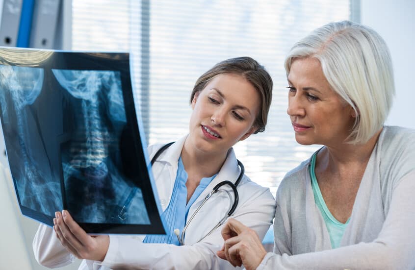 Experimental cancer drug may protect bones post-menopause