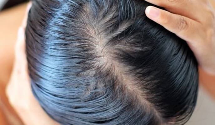 Reasons for oily hair on certain days