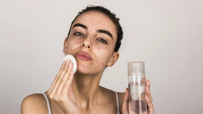 Comprehensive approach to tough acne