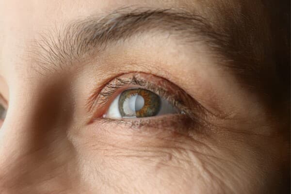 America recalls eye drops over safety concerns