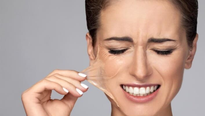 Risks of excessive exfoliation