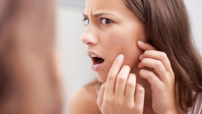 Causes of recurring pimples at same spot