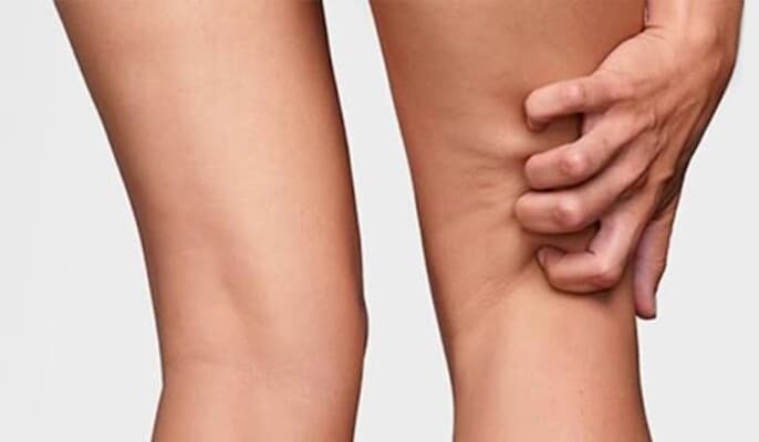 Why do we experience itching while walking