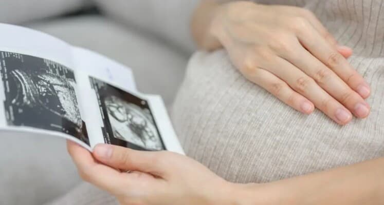 نجمة تعلن حملها الثالث عن عمر 52 عاما