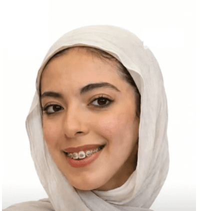 حادث يوقف حلم طالبة أردنية في اليمن