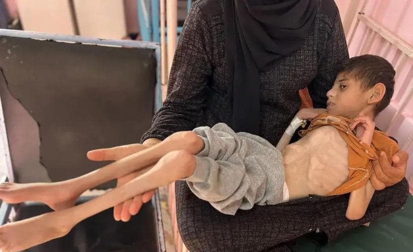 يونس.. طفولة محرومة بين فقدان البصر والجوع والمرض