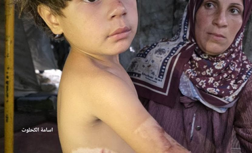 Ilene Faces Life-Saving Treatment Amid Bombings