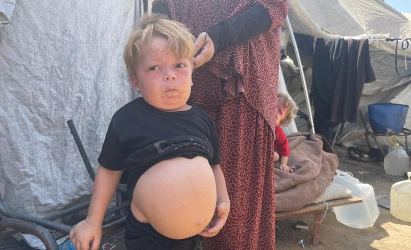 Muhammad Al-Fasfos Confronts Illness and Childhood Challenges