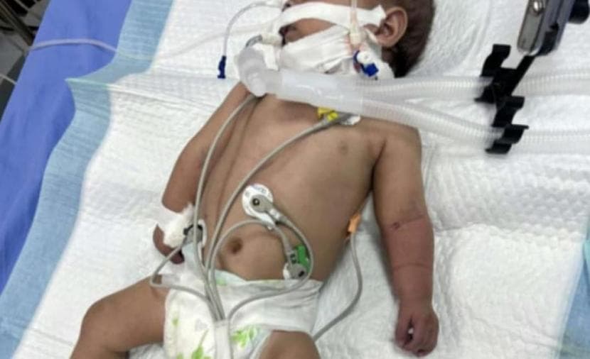 رضيع يستشهد في غزة قبل عملية قلب