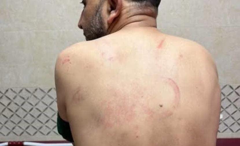 سياسي يكشف تفاصيل محاولة اغتياله في جنين