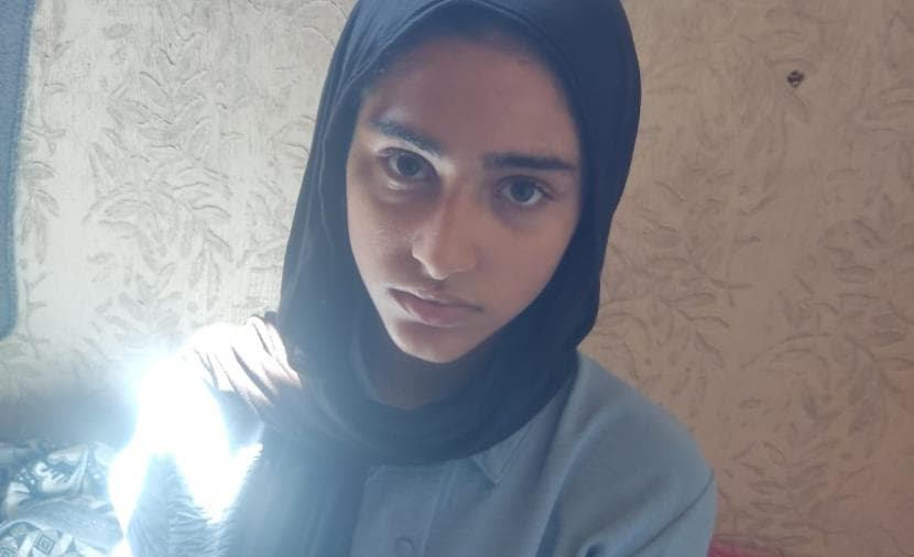 Mayar, girl exhausted by burns and treatment delay