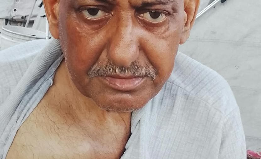 المريض الشنباري يكافح السرطان