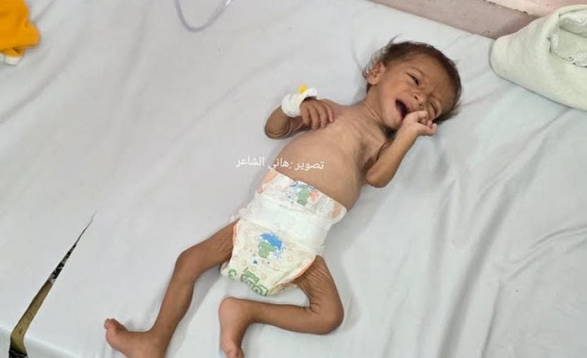 وفاة طفل نازح في غزة عن عمر 8 أشهر