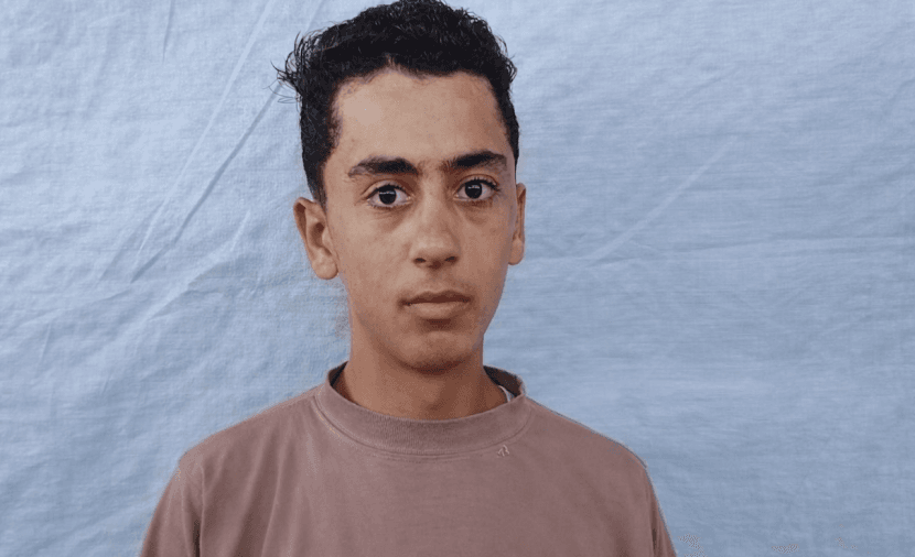 Ahmed faces two years of facial paralysis