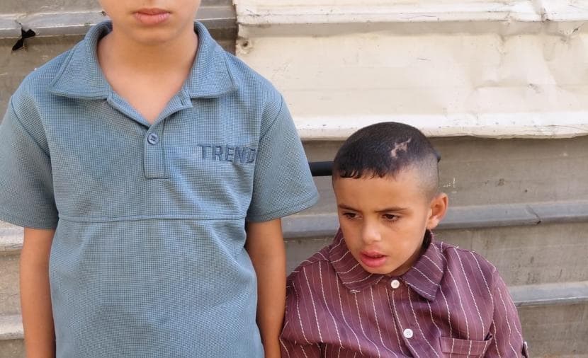 Orphaned Brothers Ismail and Elias Seek Treatment
