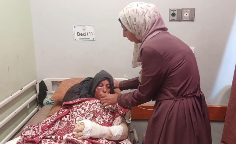 صفية حمودة تحمي وجهها من النار وفقدت ابنها