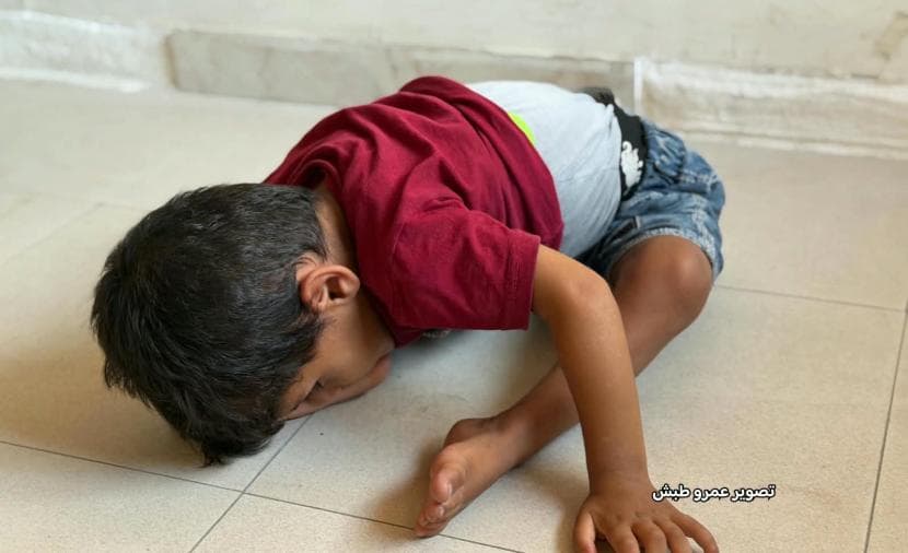حمزة.. طفل يعاني من ارتخاء عضلي بسبب الحرب