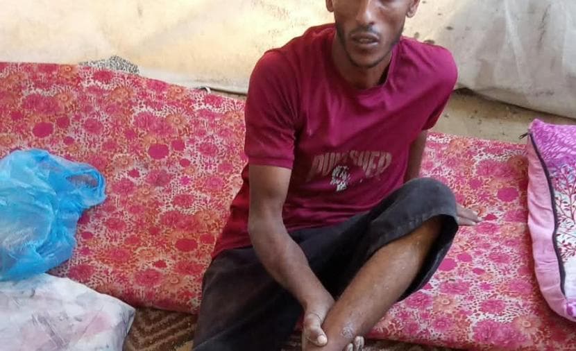 محمد الراس يأمل في طرف صناعي بعد بتر أصابع قدمه