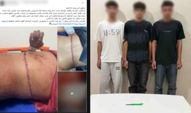 مشادة على أولوية الأجرة تتسبب في إصابة 3 طلاب بالاسماعيلية وتوقيف المتهمين