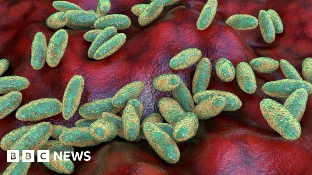 Understanding pneumonic plague spread
