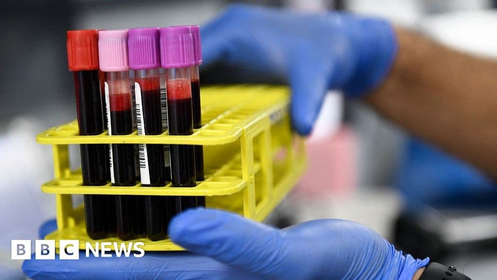 Red Cross Restart Blood Shortage Crisis