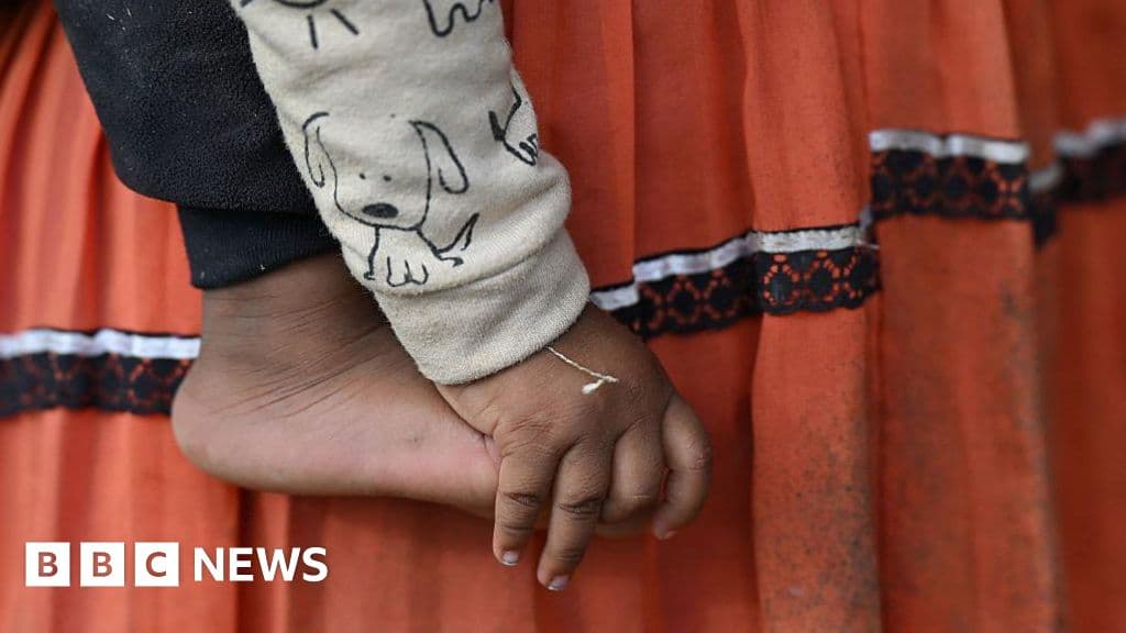 FGM: Grandmother cuts my baby secretly