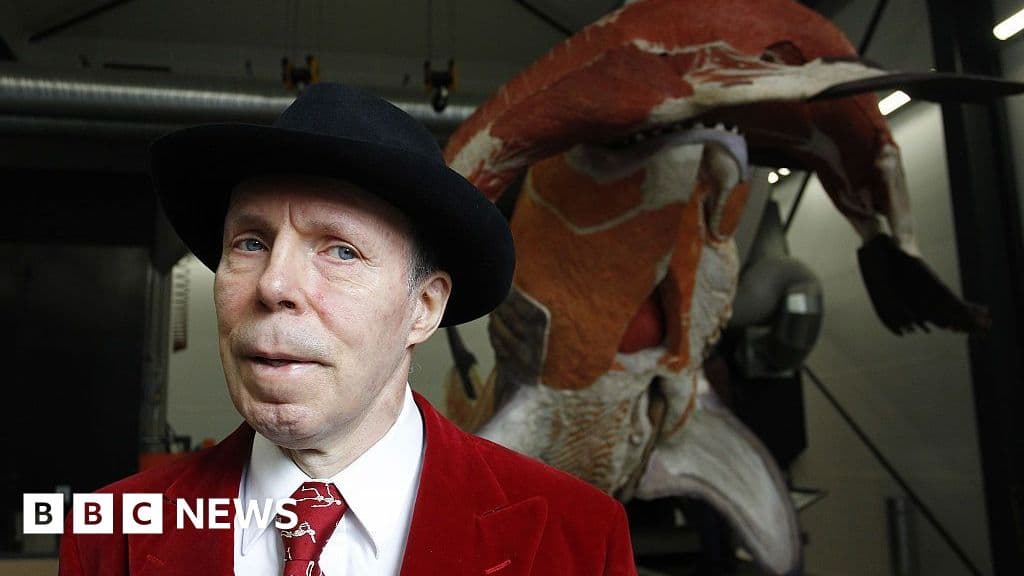 Gunther von Hagens, Creator of Body Worlds, Dies at 81