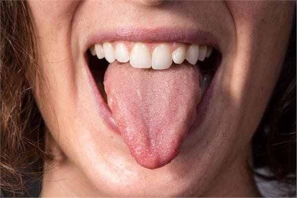 6 طرق لعلاج لسعة اللسان
