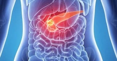 FDA Approves New Pancreatic Cancer Pill