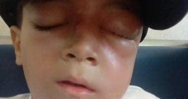 Palestinian Zeinuddin Muhammad faces Gaza's deadly arterial deformity