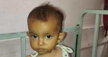 Pregnant Woman Inhaled Gas Birth of Ailing Daughter