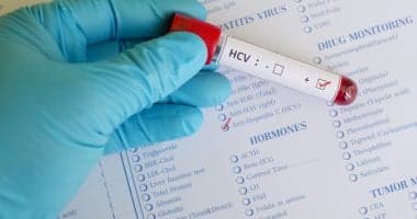 Egypt lowers hepatitis C to 0.24% under 100 Million Healthy Lives