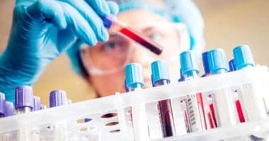 AI predicts pancreatic cancer risk years ahead